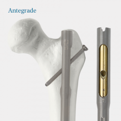 modular-femoral-system-1575461826.png